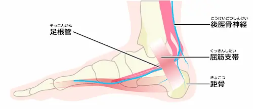 足根管症候群