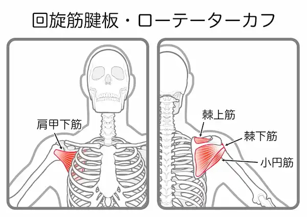 腱板炎